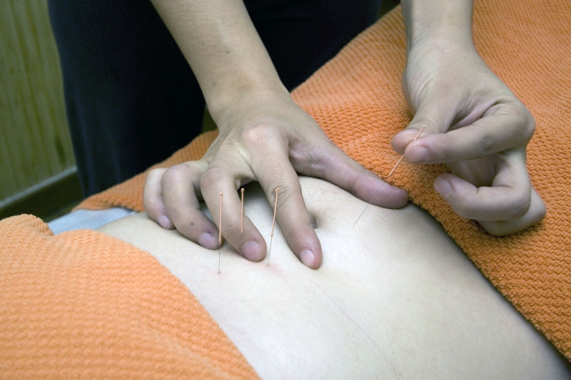 osteopathe-BELGENTIER-min_acupuncture-4175625